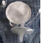 过滤器17805-G/17805-NPG库号M397069 